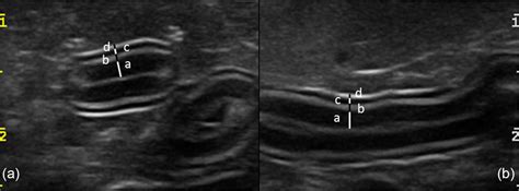 measurement of small intestine thickness cats|cat abdominal wall thickness.